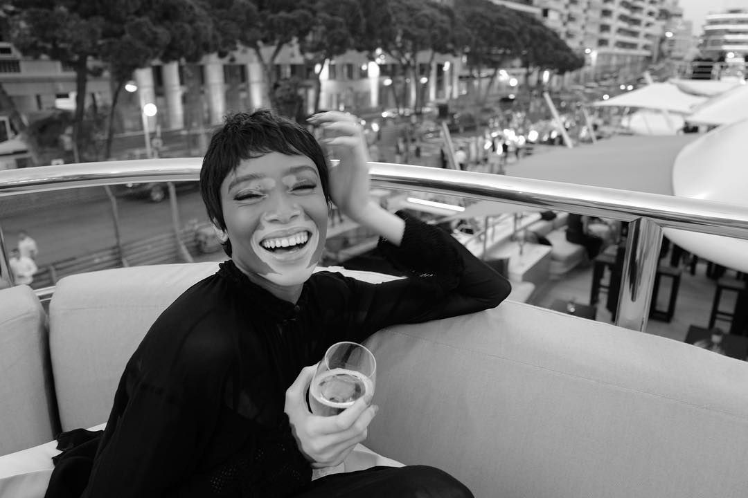 Winnie Harlow Winnie Harlow